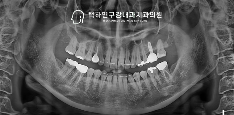 초기 문진 검사 이미지