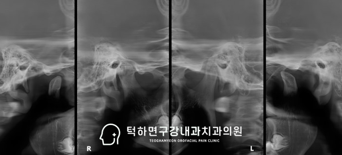 CBCT 진단 이미지