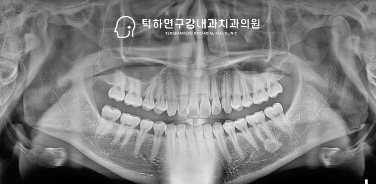 초기 문진 검사 이미지
