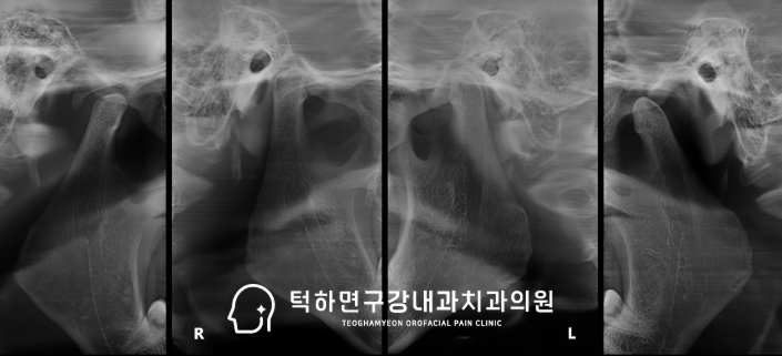 CBCT 진단 영상 이미지